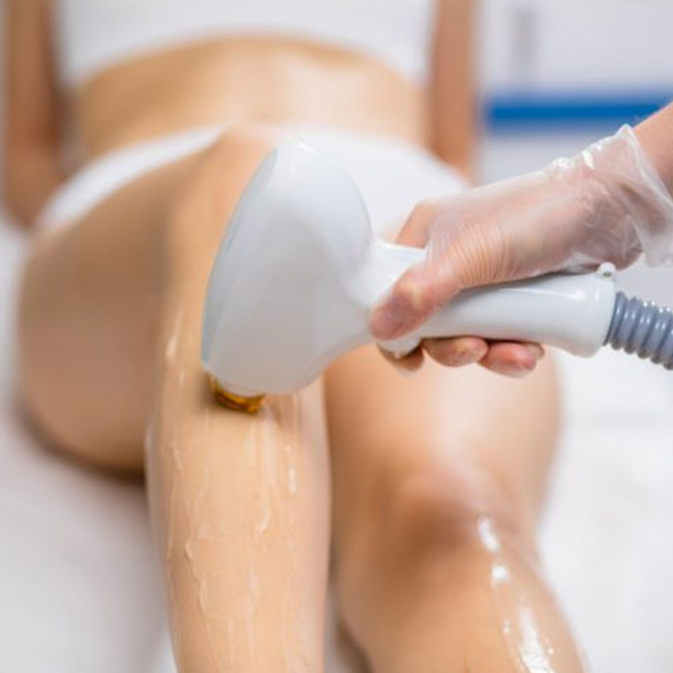 Diode Hair Removal